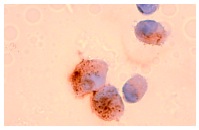 Insulin Mouse Monoclonal Antibody (2D11-H5)