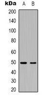 CD184 Rabbit Polyclonal Antibody