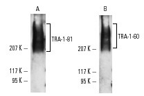 TRA-1-60 Mouse Monoclonal Antibody (TRA-1-60)