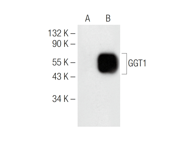 GGT1 Mouse Monoclonal Antibody (F-7)
