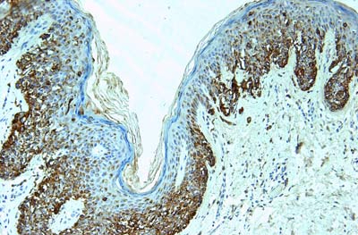 Melanoma Mouse Monoclonal Antibody(PNL2)