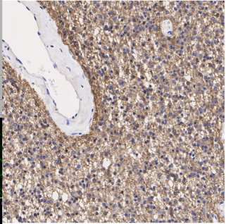 GAP43 Rabbit Monoclonal Antibody(ARA867)
