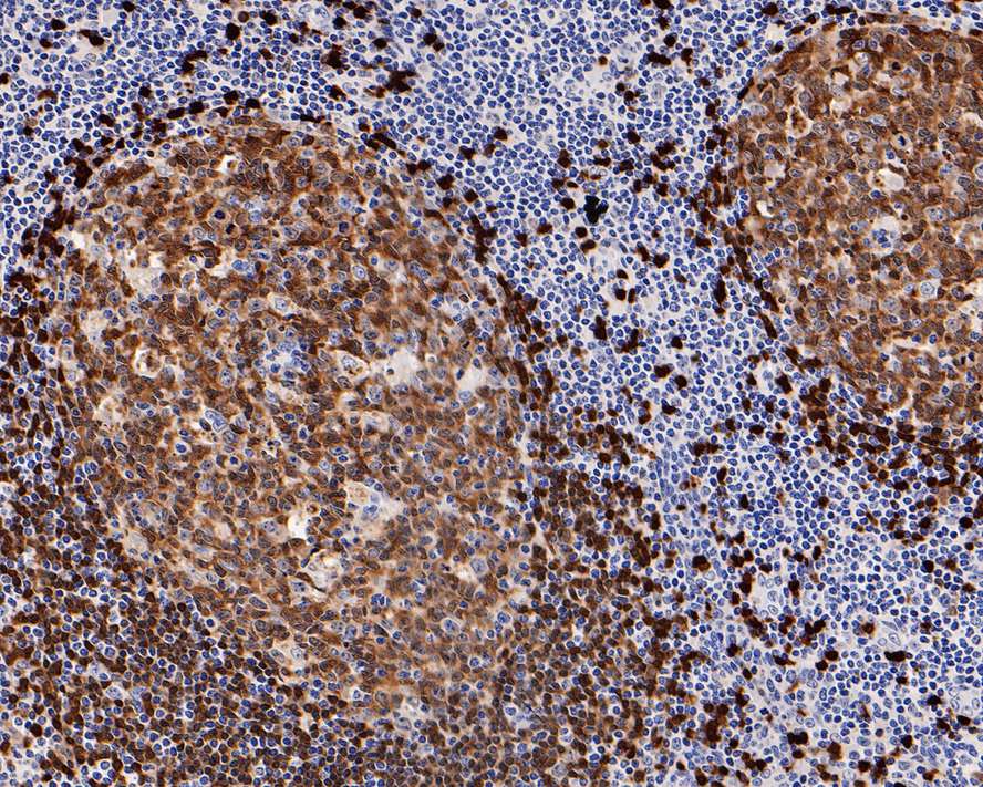 Tcl1 Rabbit Monoclonal Antibody(ARA857)