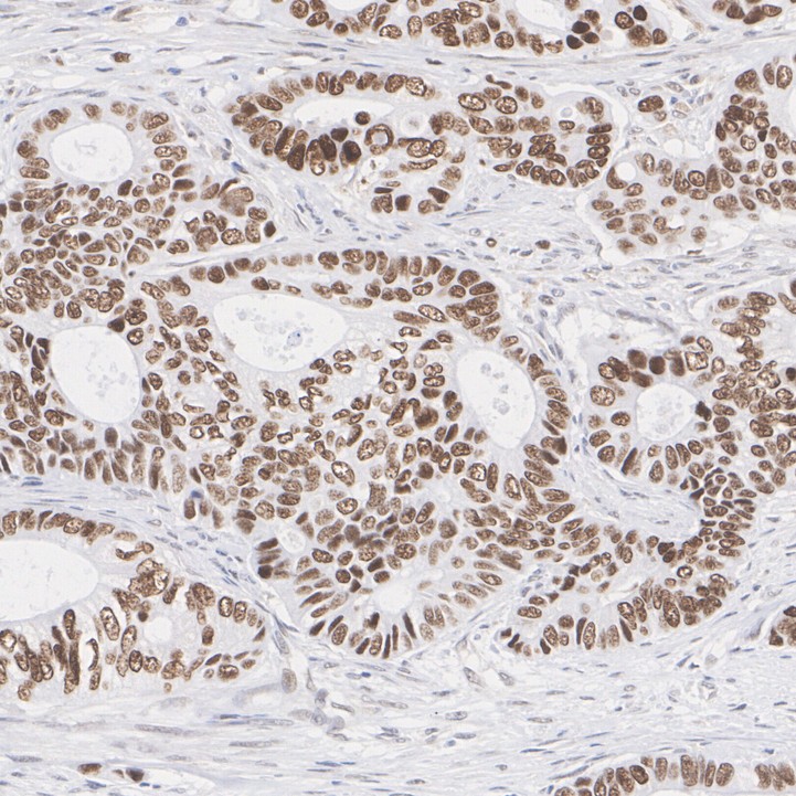 HNF-4-alpha Rabbit Monoclonal Antibody(ARA887)