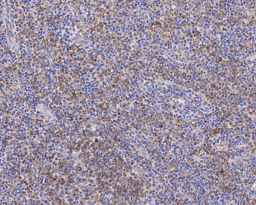 CD74 Mouse Monoclonal Antibody(ARA903)