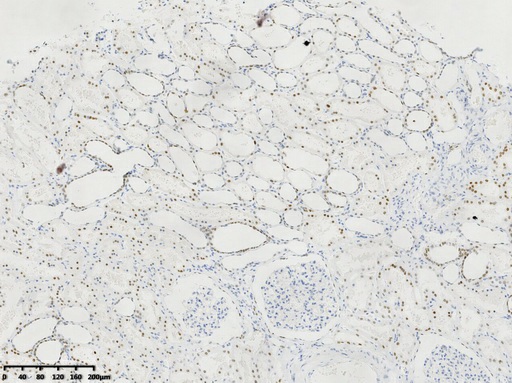 HNF1-Beta(HNF1B) Rabbit Monoclonal Antibody(ARA841)