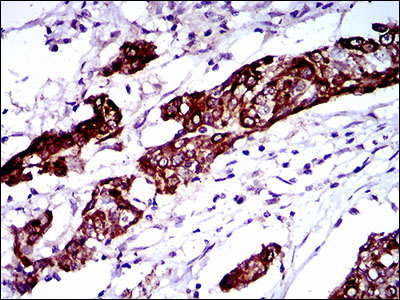 BRCA1 Mouse Monoclonal Antibody(ARA861)