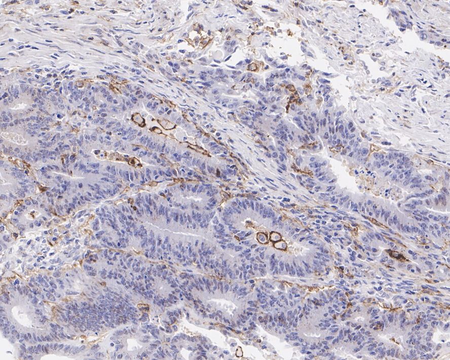 CD11c Rabbit Monoclonal Antibody(ARA881)