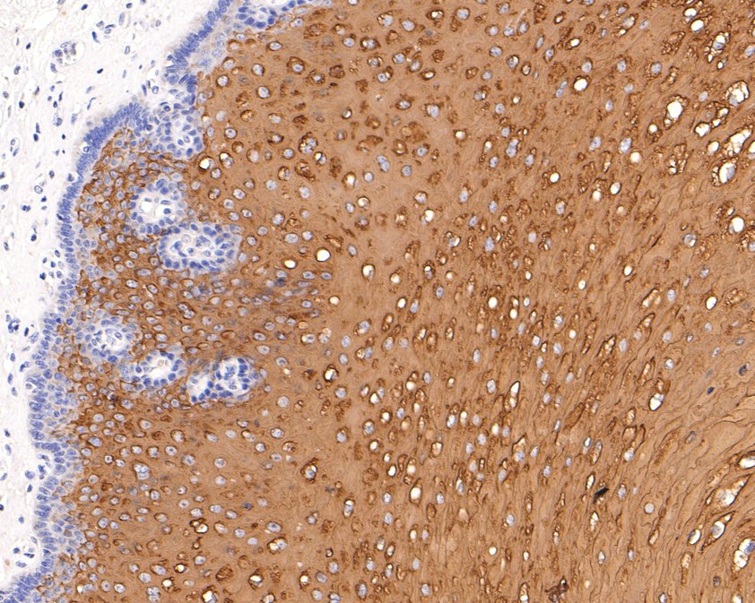 Cytokeratin 4 Rabbit Monoclonal Antibody(ARA856)