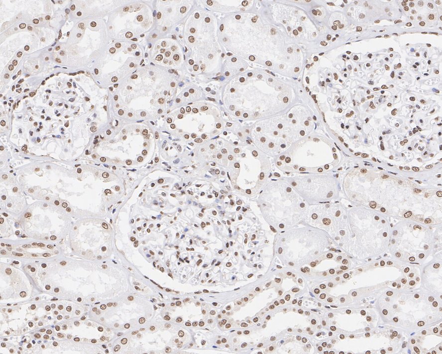 Pax2 Rabbit Monoclonal Antibody(ARA870)