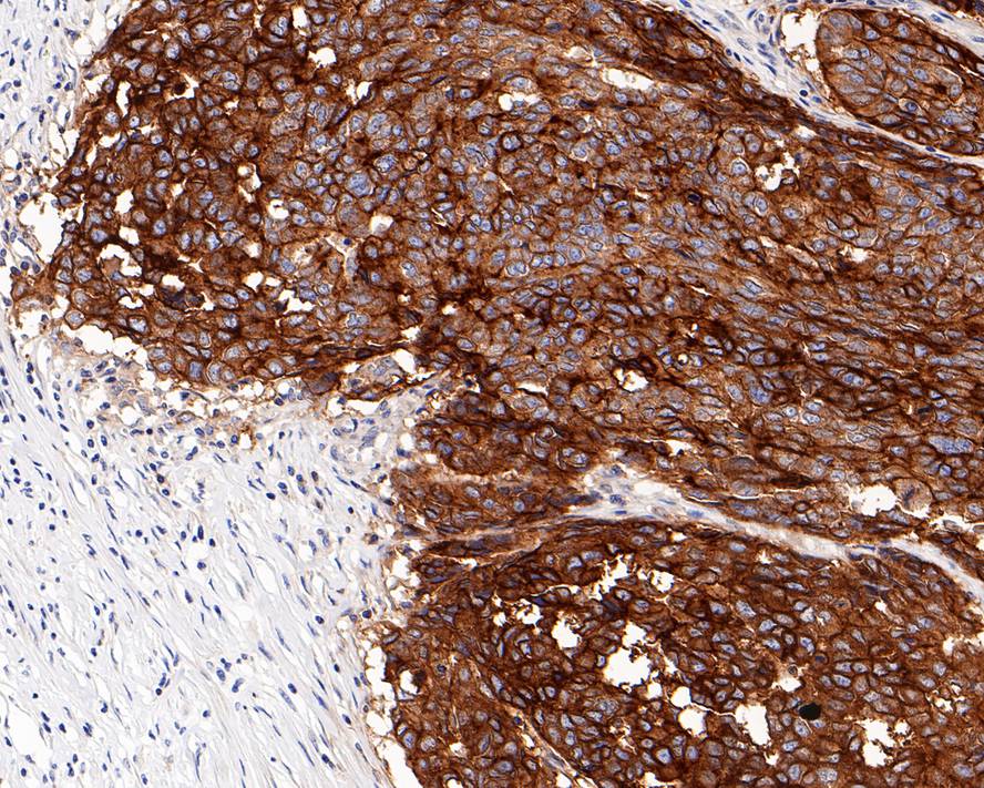 CD47 Rabbit Monoclonal Antibody(ARA866)