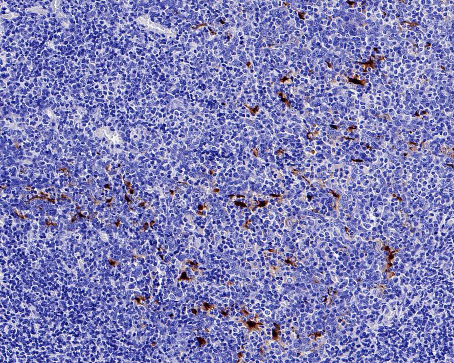 Mesothelin Rabbit Monoclonal Antibody(ARA837)