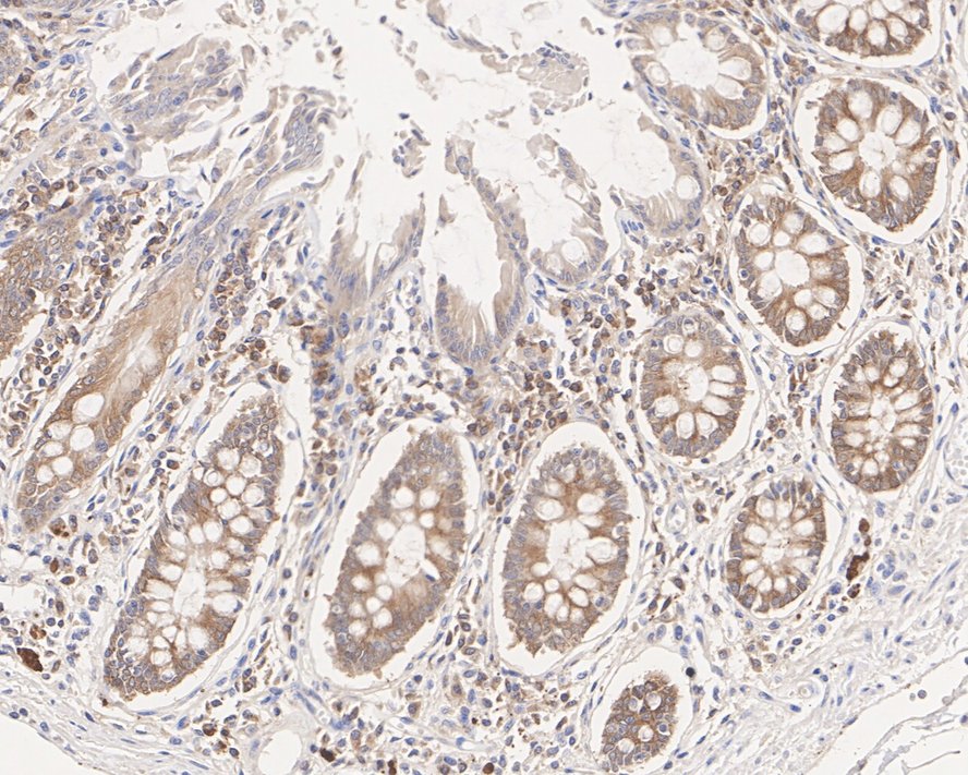 NM23 Mouse Monoclonal Antibody(ARA868)