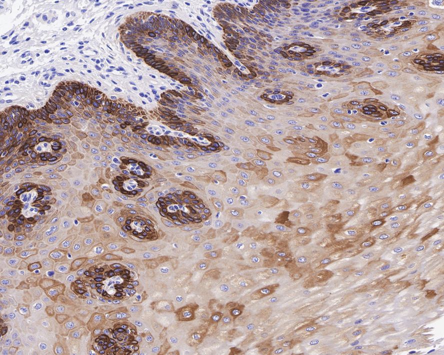 Cytokeratin 16 Rabbit Monoclonal Antibody(ARA855)