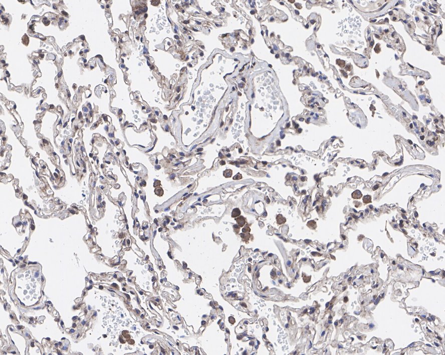 GPNMB Rabbit Monoclonal Antibody(ARA886)