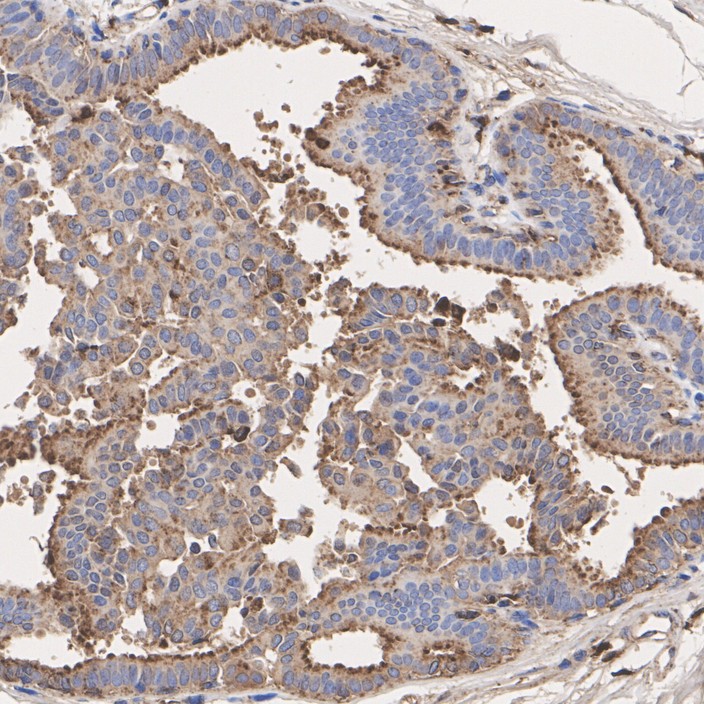 Cathepsin D Rabbit Monoclonal Antibody(ARA902)