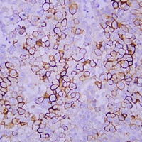 Mesothelin Mouse Monoclonal Antibody(ARA836)