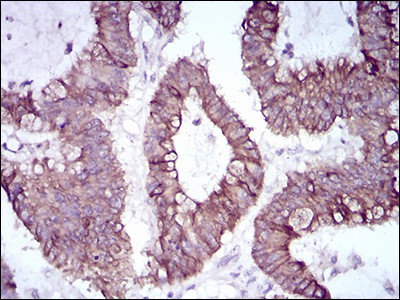 Slug Mouse Monoclonal Antibody(ARA892)
