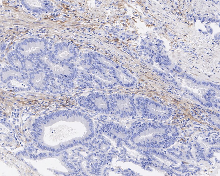 PDGFR alpha Rabbit Monoclonal Antibody(ARA871)