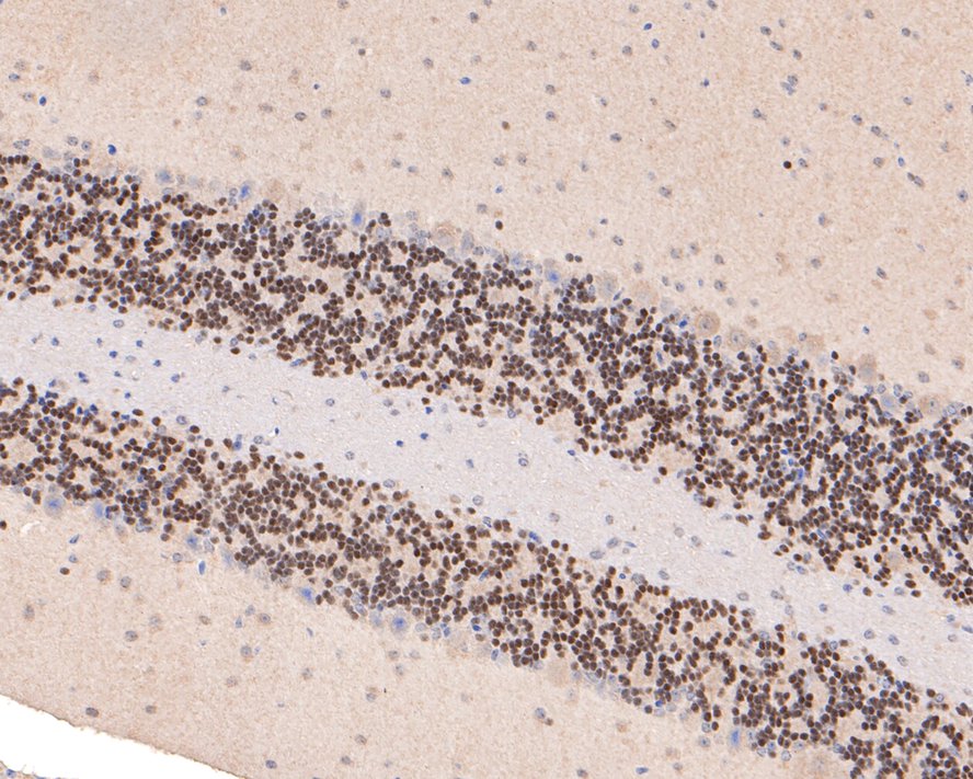 NeuroD1 Rabbit Monoclonal Antibody(ARA889)