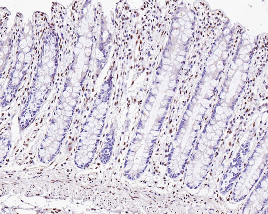 ZEB1 Rabbit Monoclonal Antibody(ARA895)