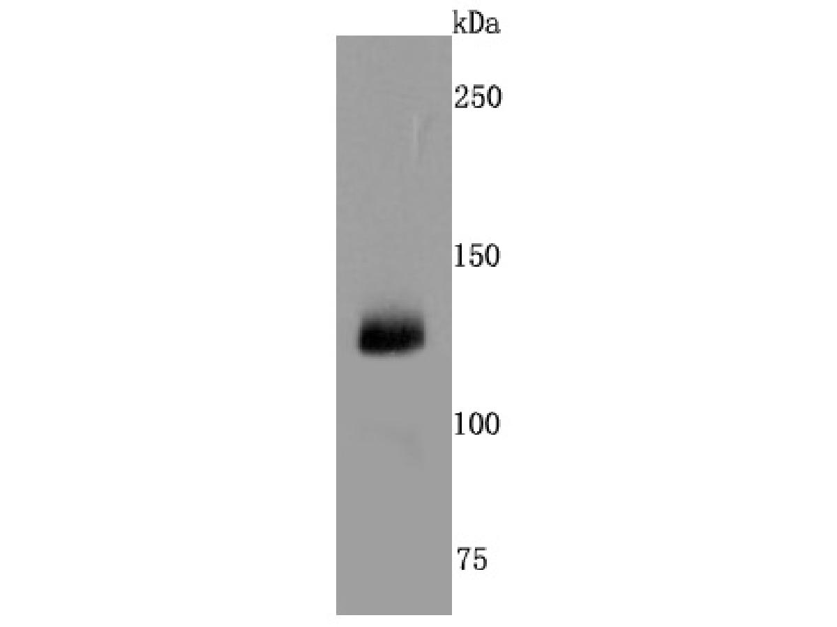CD41 Rabbit Monoclonal Antibody(ARA842)
