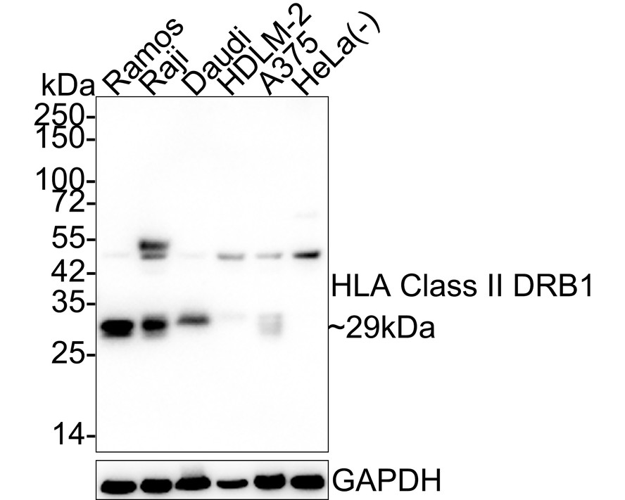 HLA Class II DRB1 Rabbit Monoclonal Antibody(ARA843)