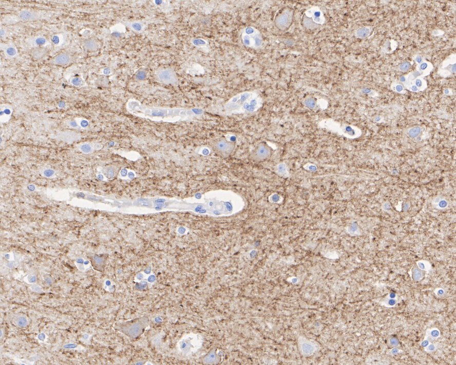 Somatostatin  receptor 2 Rabbit Monoclonal Antibody(ARA893)