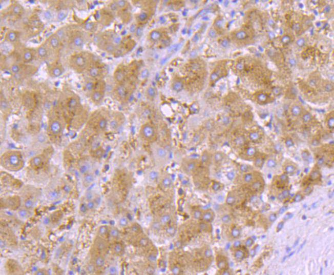 AAT Rabbit Monoclonal Antibody(ARA901)