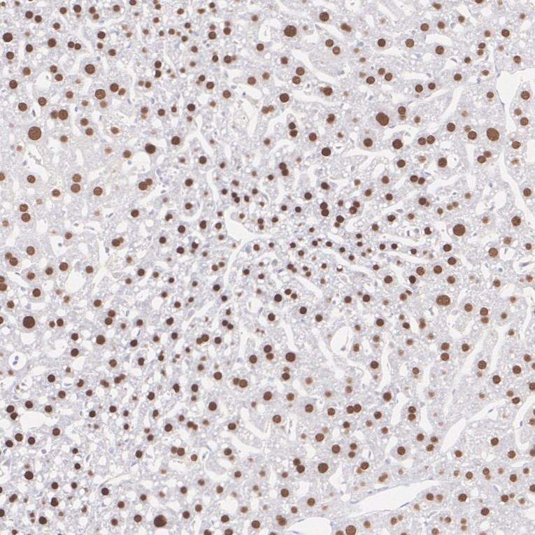 FOXA2 Rabbit Monoclonal Antibody(ARA882)