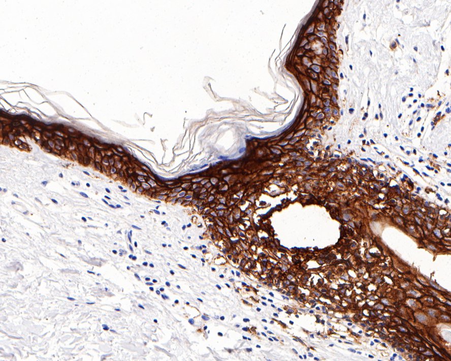 Claudin 1 Rabbit Monoclonal Antibody(ARA862)
