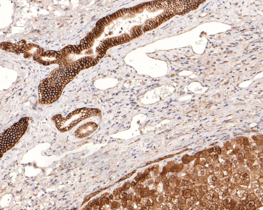 CAIX Rabbit Monoclonal Antibody(ARA899)