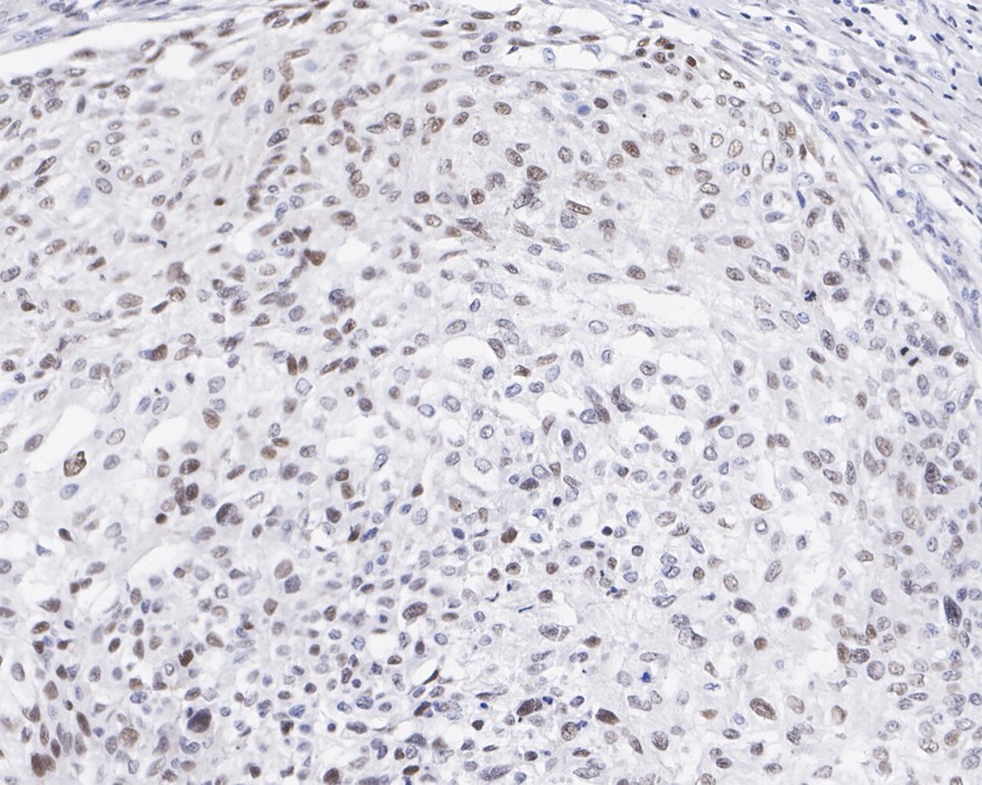 FRA1 Rabbit Monoclonal Antibody(ARA883)