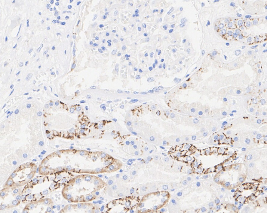 Claudin 7 Mouse Monoclonal Antibody(ARA853)