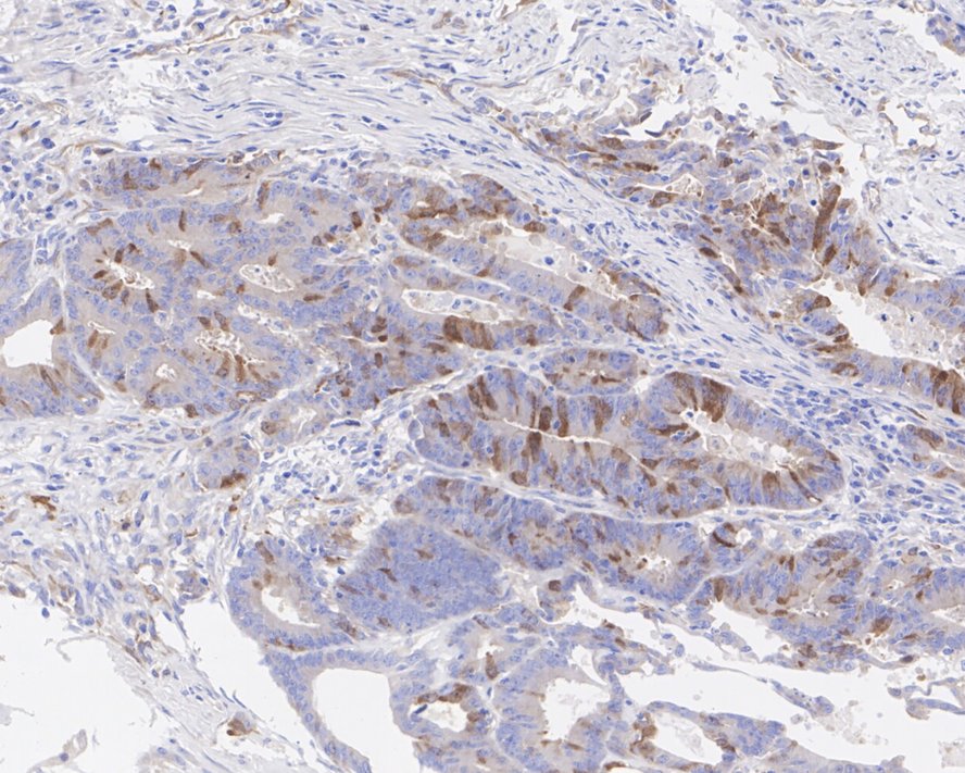 PLK1 Rabbit Monoclonal Antibody(ARA859)