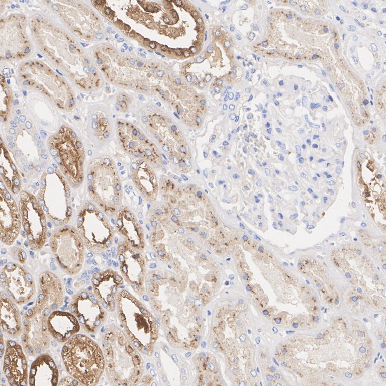 Osteopontin Rabbit Monoclonal Antibody(ARA869)