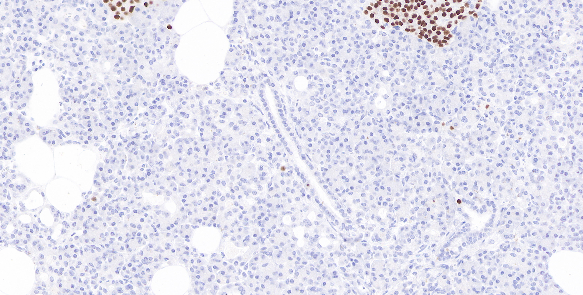 INSM1 Rabbit Monoclonal Antibody(ARB848)