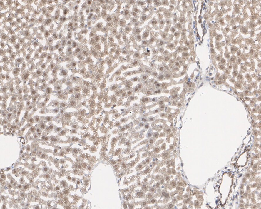 MTAP Rabbit Monoclonal Antibody(ARA878)
