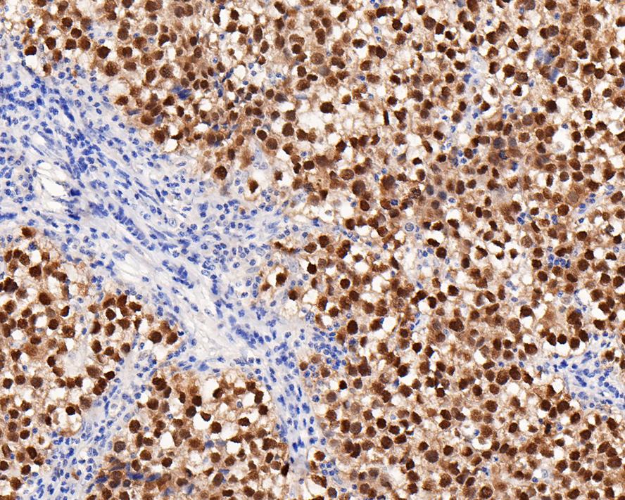 Oct4 Rabbit Monoclonal Antibody(ARA864)
