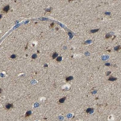 ATP8B1 Rabbit Polyclonal Antibody