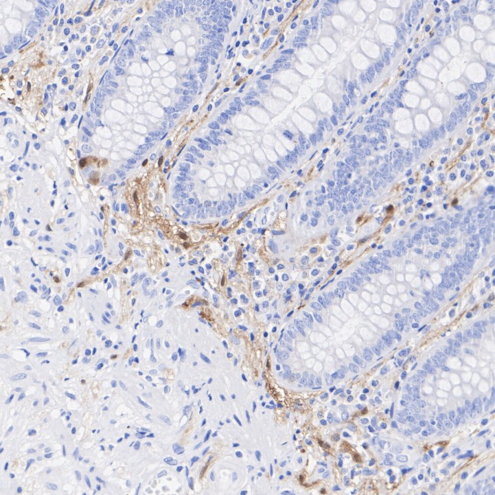 S100 Rabbit Monoclonal Antibody(ARA945)