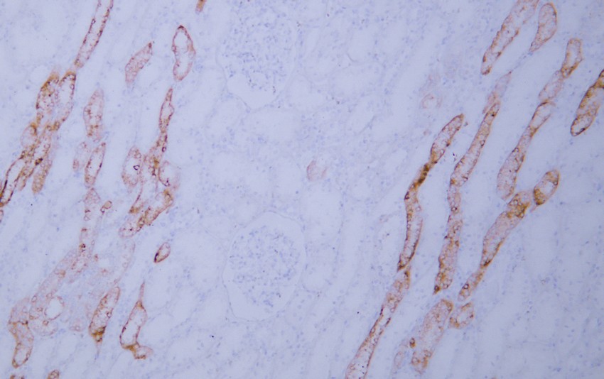 PAP Mouse Monoclonal Antibody(ARA918)