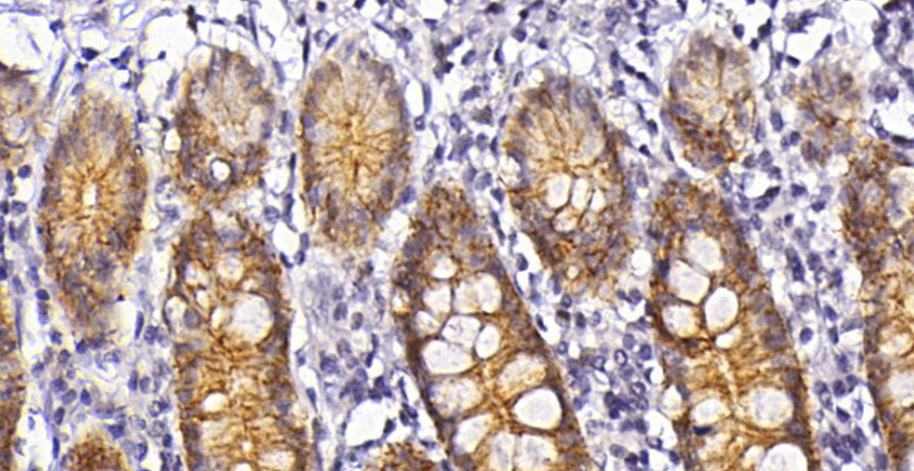Claudin-3 Mouse Monoclonal Antibody(ARA925)