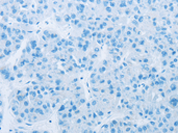 CYP11B1 Rabbit Polyclonal Antibody