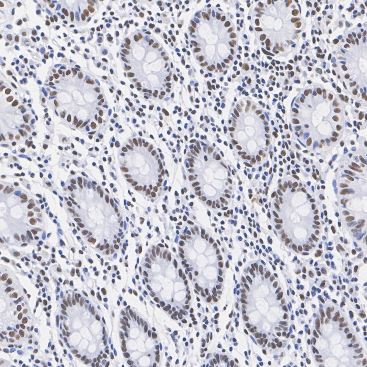 ARID1A Rabbit Monoclonal Antibody(ARA930)