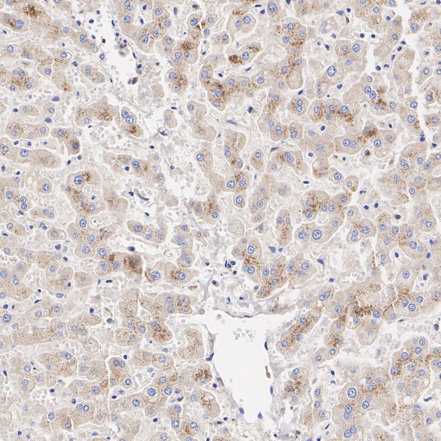 Tyrosinase Rabbit Monoclonal Antibody(ARA914)