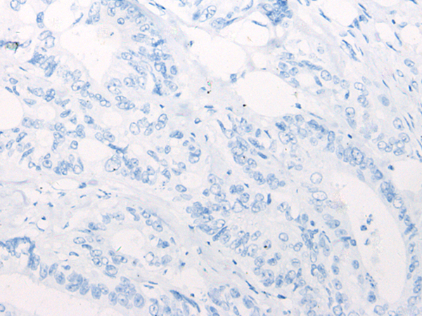 ARID1B Rabbit Polyclonal Antibody