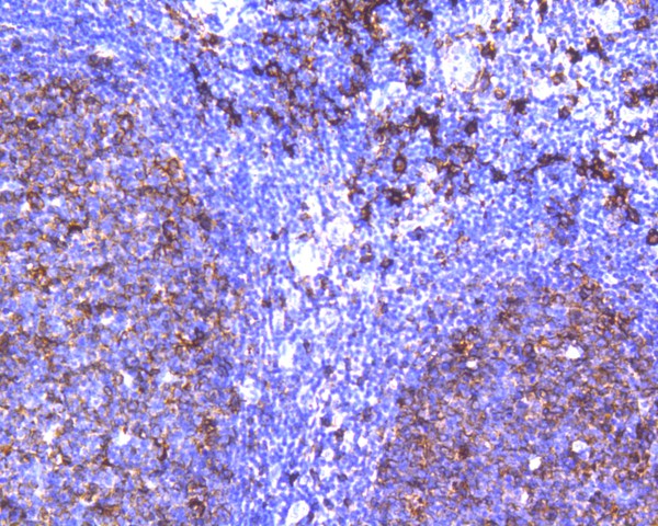 HLA-DR Rabbit Monoclonal Antibody(ARA916)