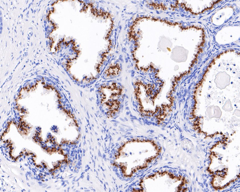 SLC45A3&nbsp;Rabbit&nbsp;Monoclonal&nbsp;Antibody(ARA937)