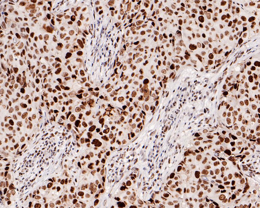 Rb Rabbit Monoclonal Antibody(ARA919)